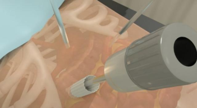 Swiss Startup - Amarastesia Additional Image