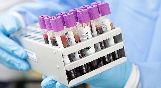 Swiss Startup - Araris Biotech Product Image