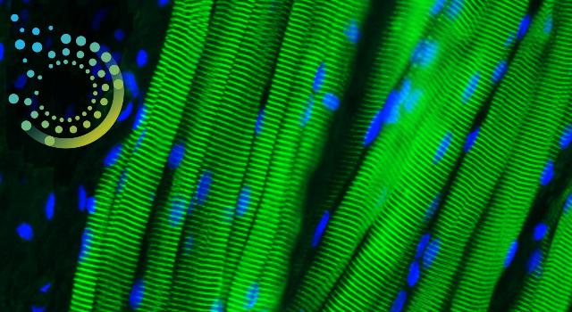 Swiss Startup - MUVON Therapeutics Main Image