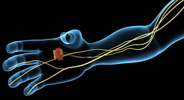 Swiss Startup - Neurotune Main Image