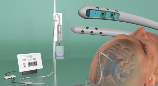 Swiss Startup - Rhovica Neuroimaging Main Image