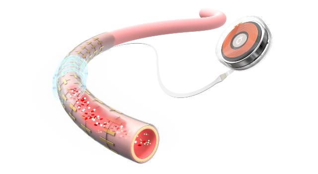 Swiss Startup - Roumai Medical (Switzerland) Product Image