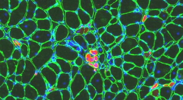 Swiss Startup - SEAL Therapeutics Main Image