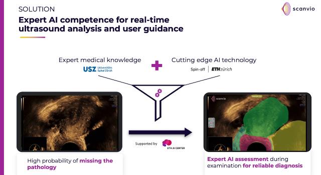 Swiss Startup - Scanvio Medical Product Image