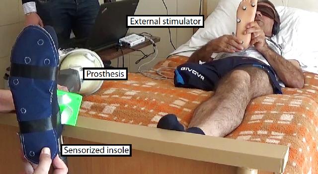 Swiss Startup - SensArs Neuroprosthetics Product Image