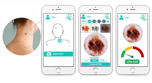 Swiss Startup - SkinMind Product Image