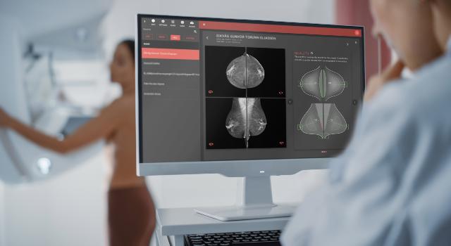 Swiss Startup - b-rayZ Product Image