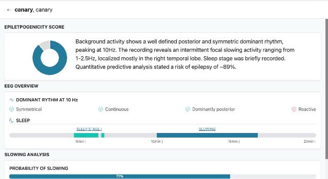 Swiss Startup - dEEGtal Insight Product Image