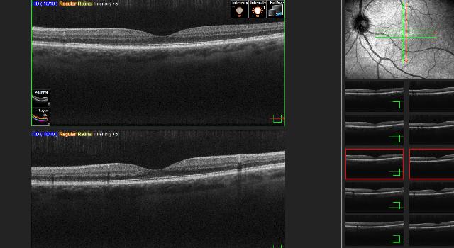 Swiss Startup - ebovis (Augenpraxis) Additional Image